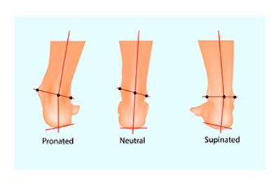 Foot Pronation and its Impact on the Lower Back